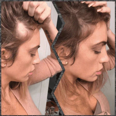 Toppik Hair Fiber - Apenas Kits