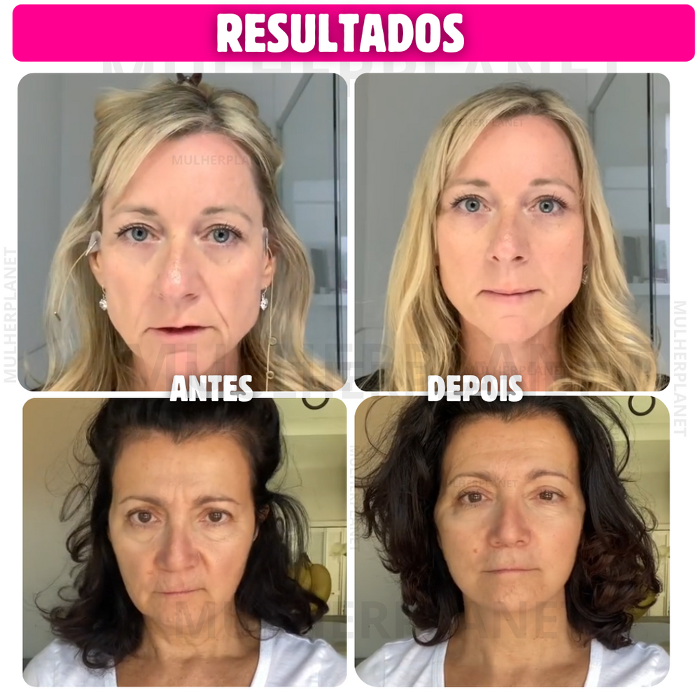LiftFace - Adesivos para rugas no rosto