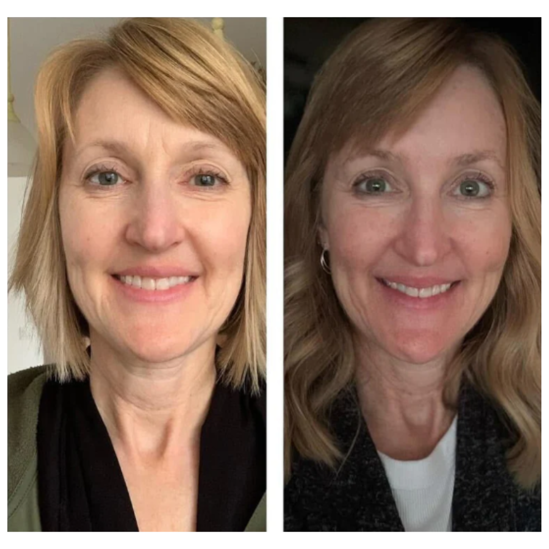 Facial Patches - Adesivos destacáveis prontos para aplicar
