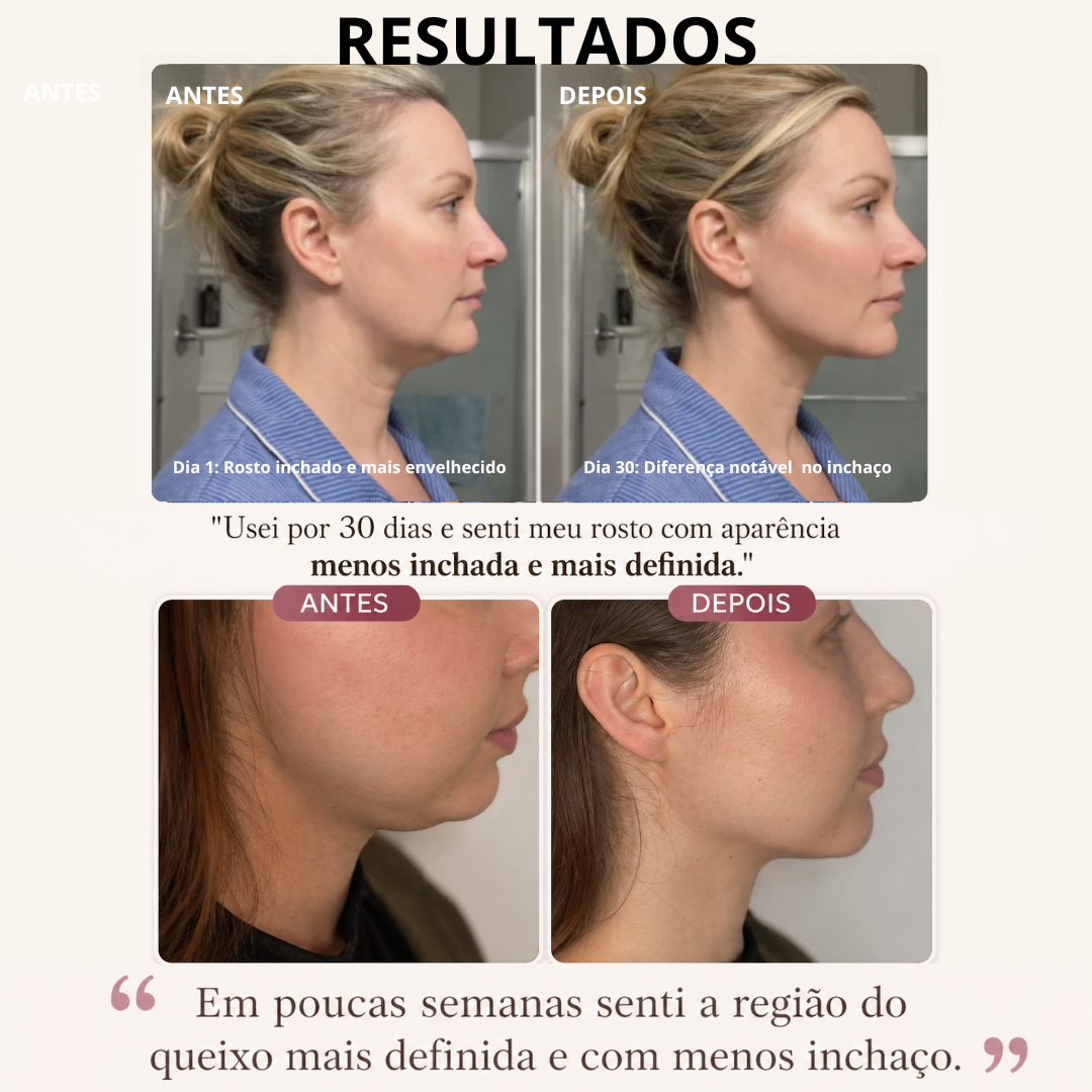LiftRoller - Aparelho de massagem com Radiofrequencia+EMS+Ledterapia +Vibração
